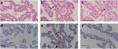 PEGylated Recombinant Human Growth Hormone Jintrolong® Exhibits Good Long-Term Safety in Cynomolgus Monkeys and Human Pediatric Growth Hormone Deficiency Patients